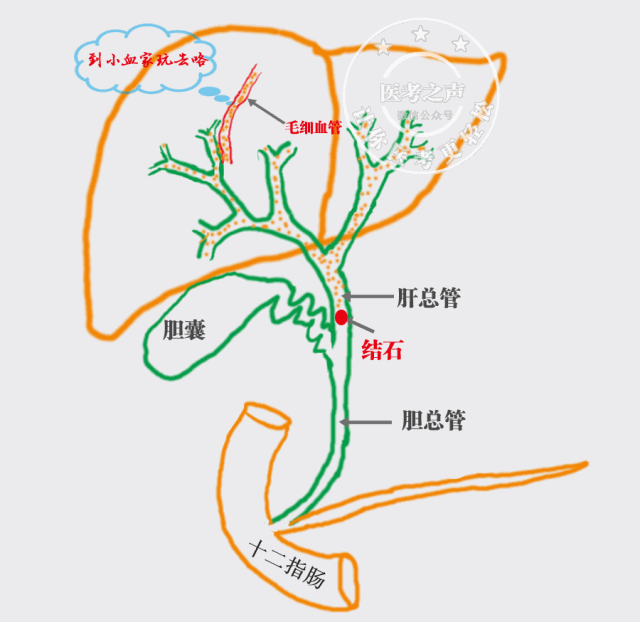 这些胆汁,细菌,毒素 逆流入血 大坏蛋 — 细菌内毒素进入血液循环