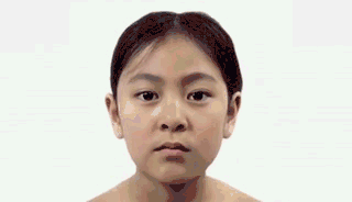 皱纹,眼袋出现