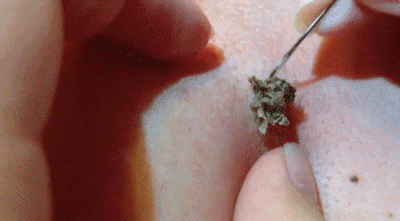 咦~简直太恶心了!