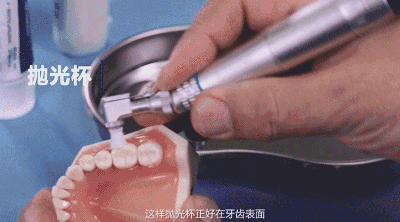美白小圆头