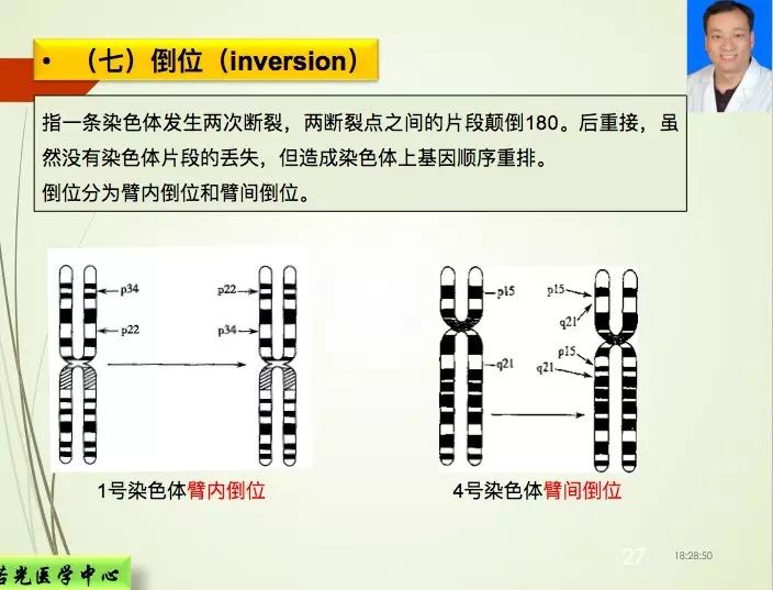 [染色体](1)3号及9号染色体臂间倒位