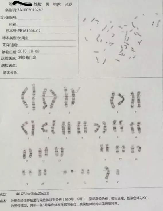 [染色体](1)3号及9号染色体臂间倒位