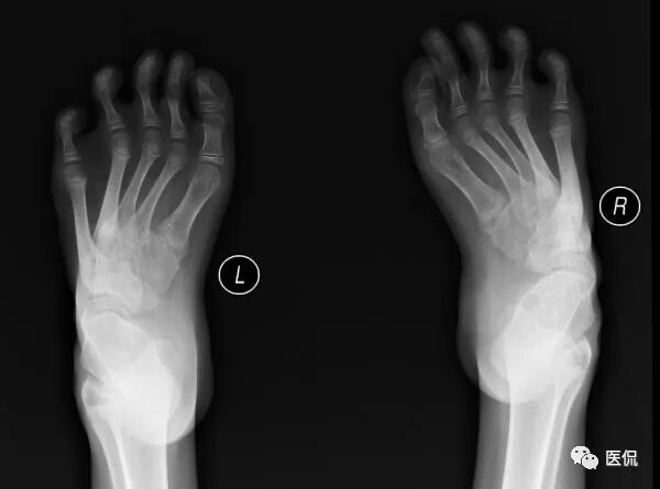 足部骨骼构造_人体骨骼足部_足部骨骼图