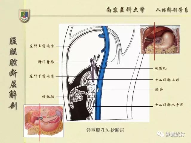 【解剖】腹膜及腹膜腔(经典讲解汇总)