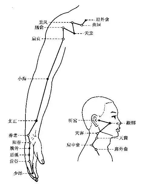 颧髎穴:颧骨高点骨下取之. 听宫穴:耳屏前凹陷.