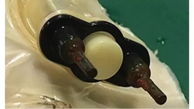 手电极怎么用冬季寒冷 但电极式暖手宝千万别用！很容易爆炸！_https://www.jmylbn.com_新闻资讯_第1张