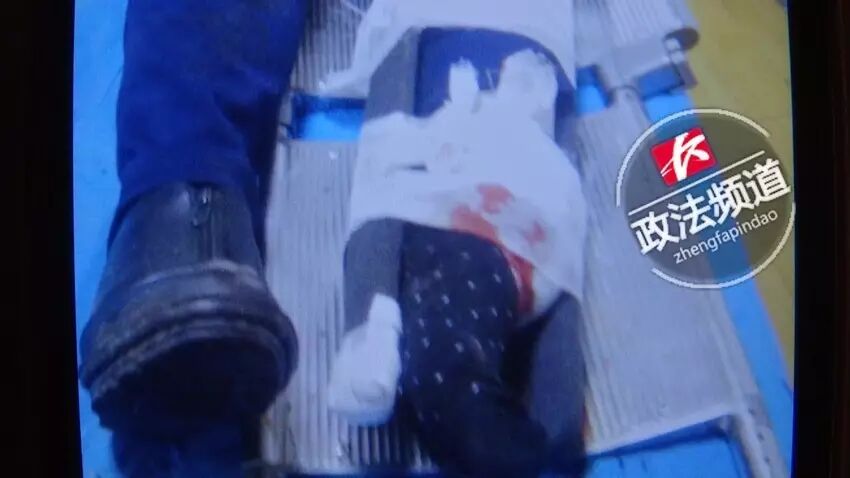 ▲伤者被送往医院