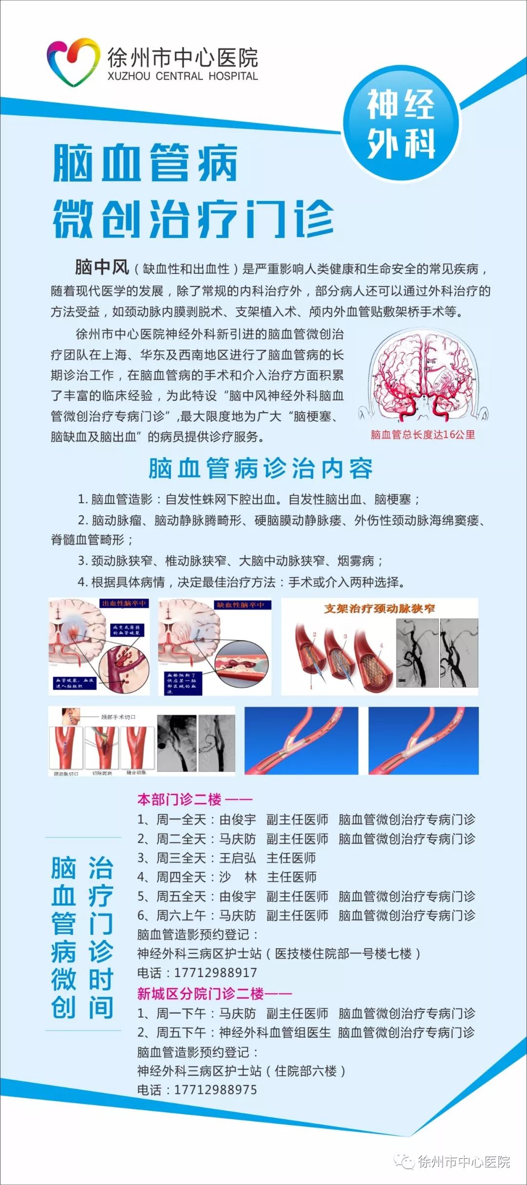 我院新增2个神经外科专病门诊