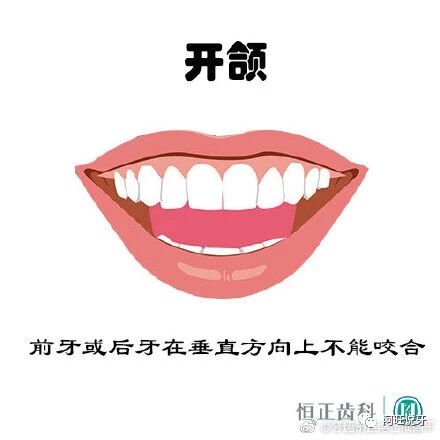 什么牙需要矫正呢？几张图画告诉你