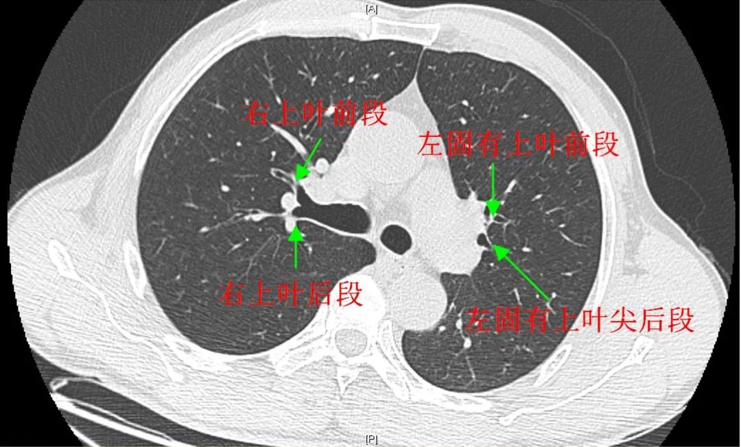 67初学3部曲支气管树胸部ct支气管镜技术