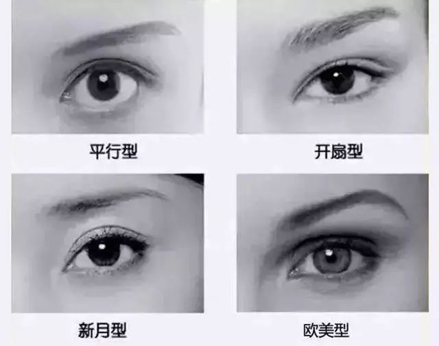 平行型双眼皮是指眼皮与上睑睑缘基本平行,重睑不超过外眼角.