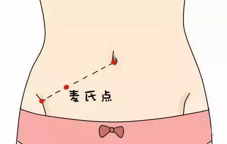 阑尾炎发作时,这个部位常可表现为明显的压痛,也是选择阑尾手术切口的