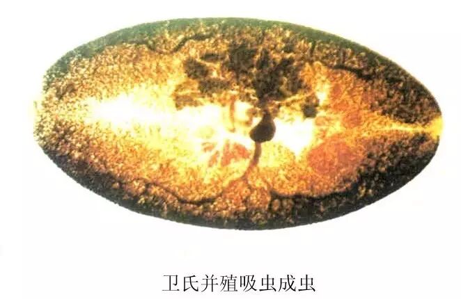 肺吸虫也称"卫氏并殖吸虫",体呈卵圆形,长7~15毫米,宽3~8毫米.
