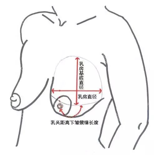 柳岩的胸好真,看起来比张馨予的胸软多了!