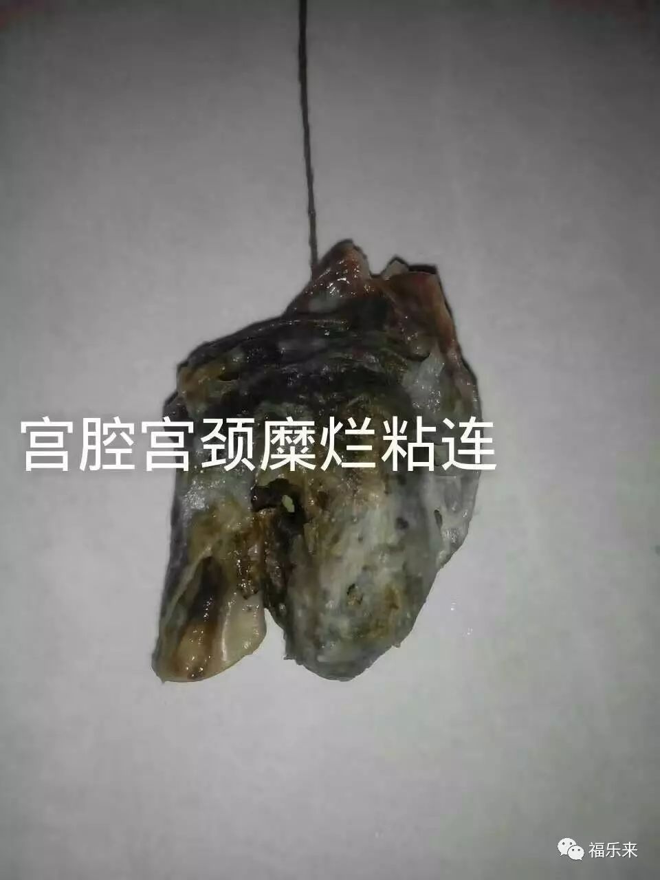 贺氏纯中药清宫丸有那么大的威力吗?是不是真的哦.