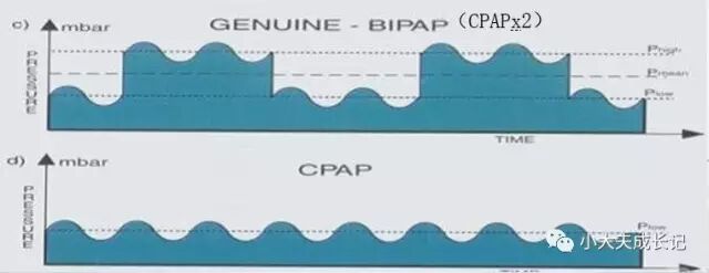 epap什么模式无创呼吸机（二）_https://www.jmylbn.com_新闻资讯_第86张