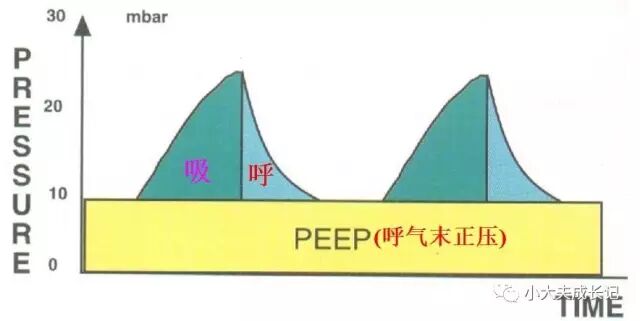 epap什么模式无创呼吸机（二）_https://www.jmylbn.com_新闻资讯_第84张