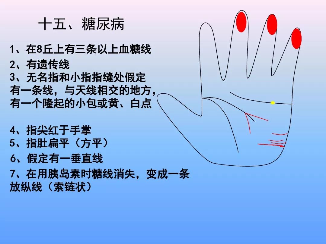 最全手诊图谱,自己对照看看吧!(非常实用)