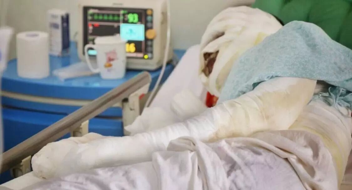 湖滨小吃店爆炸后续:4名高中生烧伤,包扎形如