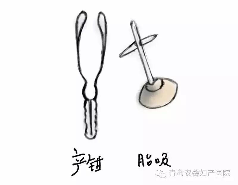 第一胎剖宫产第二胎可以顺产吗?-怀孕期