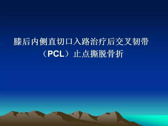 膝后内侧直切口入路治疗后交叉韧带