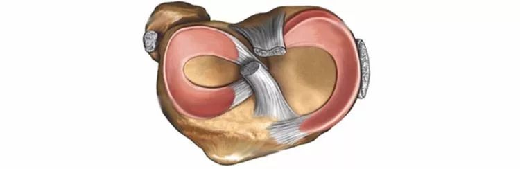 外侧半月板对膝关节的旋转稳定,尤其当膝关节存在后外侧不稳定时有