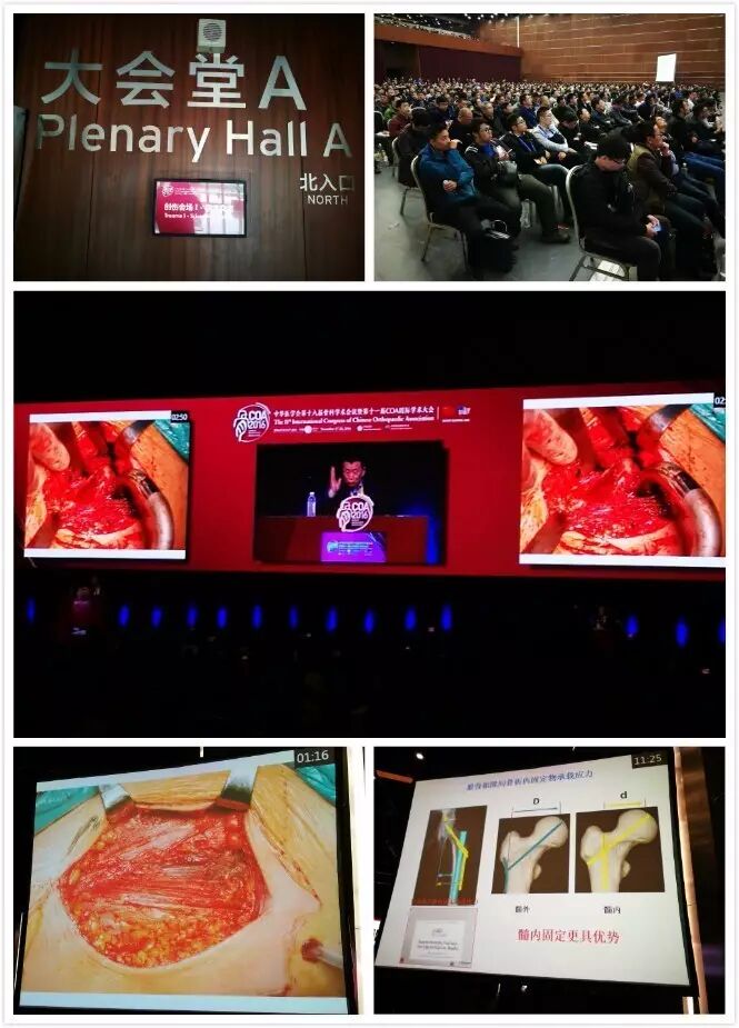 【回顾COA】23个分会场照片集锦--精彩瞬间记录