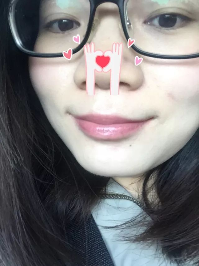 痘印的解决方法_痘印心得经验_痘印的烦恼