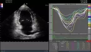 日立彩超怎么样日立超声系统ARIETTA 70、ARIETTA 60_https://www.jmylbn.com_新闻资讯_第7张