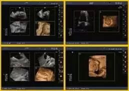 日立彩超怎么样日立超声系统ARIETTA 70、ARIETTA 60_https://www.jmylbn.com_新闻资讯_第6张