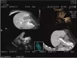 日立彩超怎么样日立超声系统ARIETTA 70、ARIETTA 60_https://www.jmylbn.com_新闻资讯_第8张