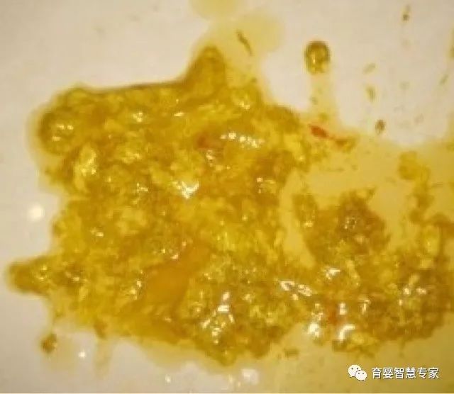 (2),轮状病毒肠炎 也就是常说的秋季腹泻,孩子最早出现发热和呕吐