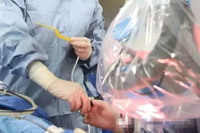 手术室无影灯怎么安装直击手术室 ｜ 无影灯下，你以为递把手术刀很简单？_https://www.jmylbn.com_新闻资讯_第13张