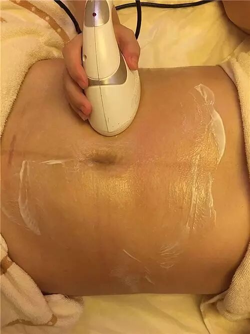 瘦身建议及方法_瘦身减肥方案_瘦身方案