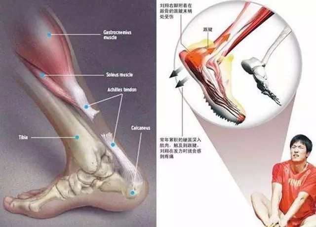 讲到这里,我突然想到了刘翔,很多朋友都责怪他奥运会跟腱断裂后,没有