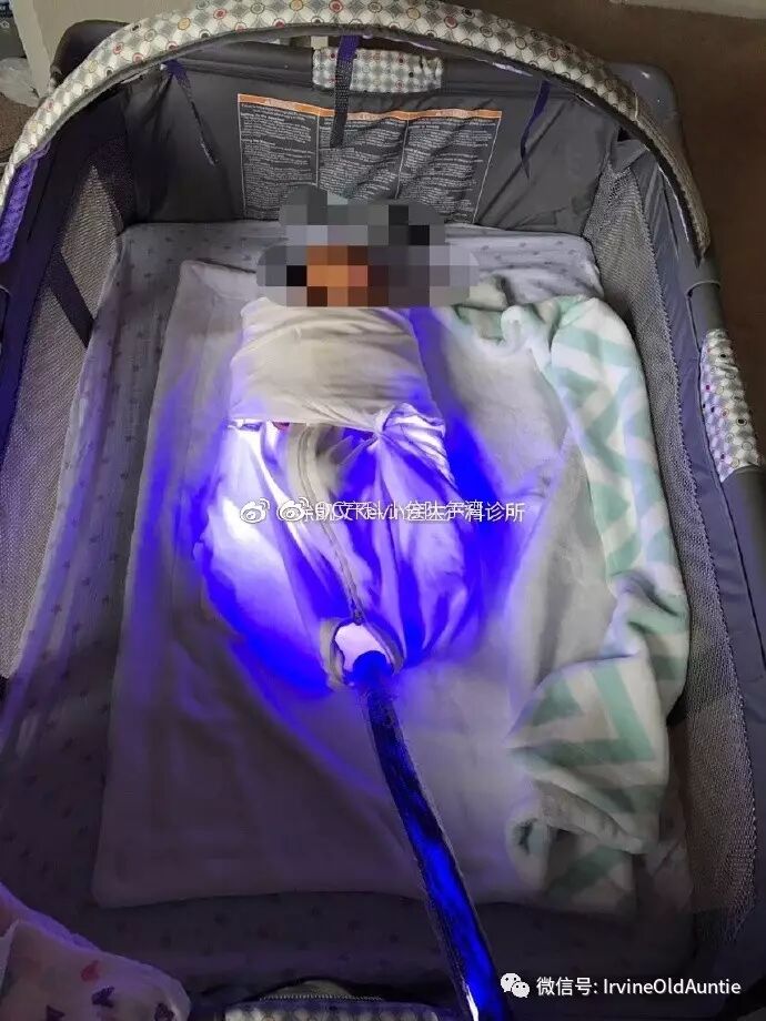 蓝光毯有哪些厂家黄疸高 =必须去医院照贵价蓝光？ 你还有Bili Blanket！_https://www.jmylbn.com_新闻资讯_第4张