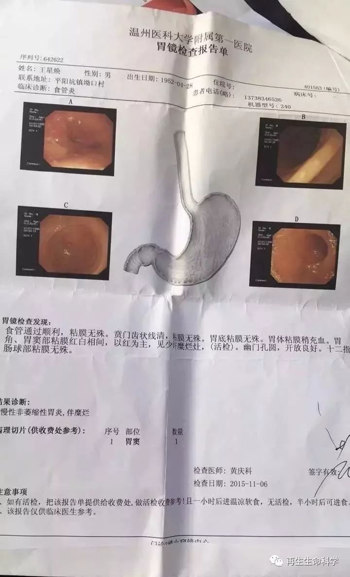 65岁的长辈,胃糜烂一个月就都修复好了,太棒了!