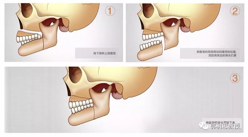 用外科和正畸学的方法作为治疗手段,其主要治疗对象是各种牙颌面畸形