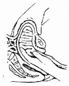 为什么医院的纱布不卖1分钟成功取出纱布，索赔300000块钱，滞留医院100800分钟，这么闹，好玩吗？_https://www.jmylbn.com_新闻资讯_第8张
