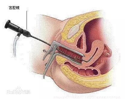 为什么医院的纱布不卖1分钟成功取出纱布，索赔300000块钱，滞留医院100800分钟，这么闹，好玩吗？_https://www.jmylbn.com_新闻资讯_第9张