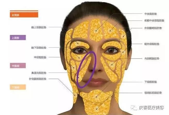 自体脂肪填充鼻唇沟还你平滑美肌