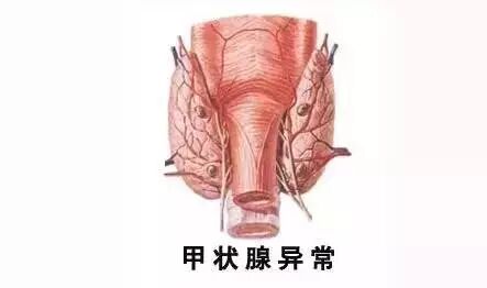 诱发胎停育的元凶有哪些,备孕的美眉看好啦!-怀孕期