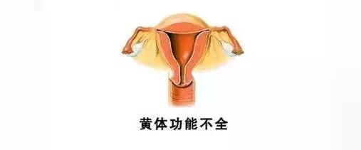 诱发胎停育的元凶有哪些,备孕的美眉看好啦!-怀孕期