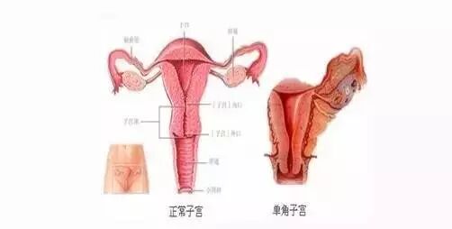 诱发胎停育的元凶有哪些,备孕的美眉看好啦!-怀孕期