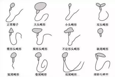 诱发胎停育的元凶有哪些,备孕的美眉看好啦!-怀孕期