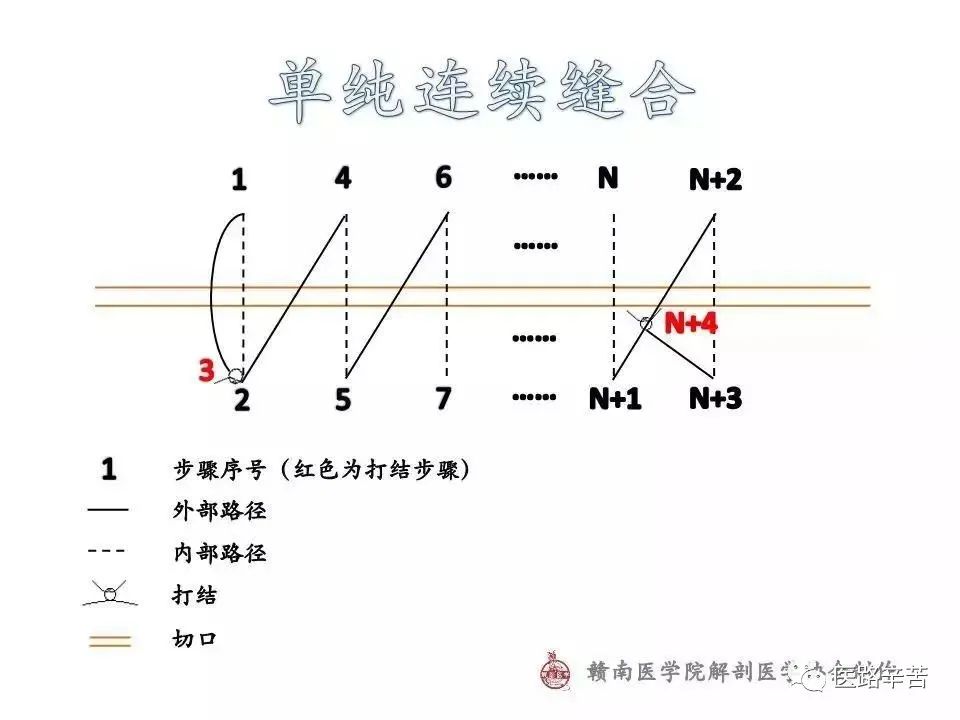 常用外科缝合路径图解