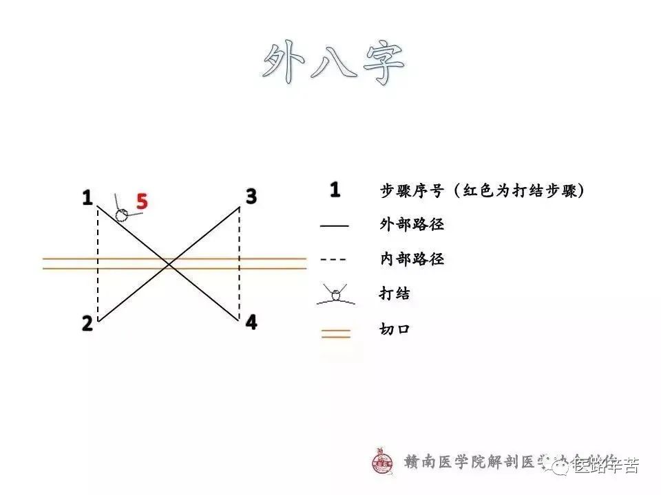 常用外科缝合路径图解