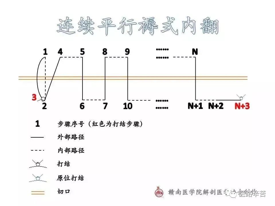 常用外科缝合路径图解