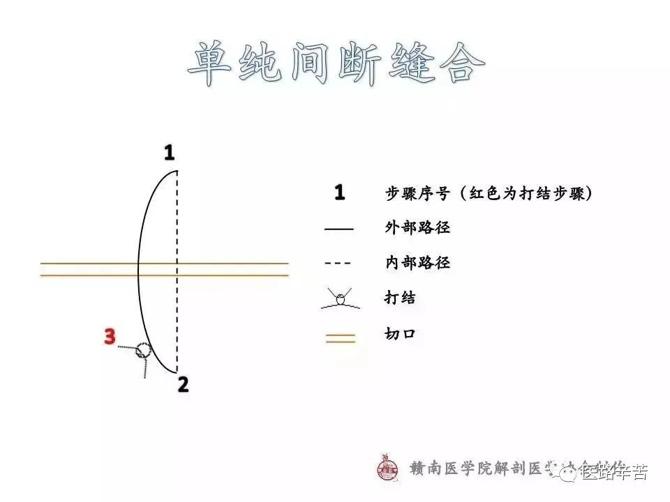 常用外科缝合路径图解