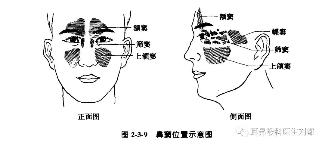 鼻窦炎需要手术治疗吗?